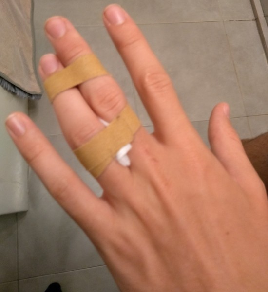 Lifeguard assessment, with a finger fracture