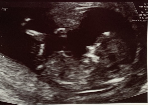 Can you tell gender from these pics?