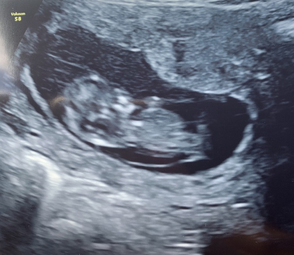 March 2021 #2