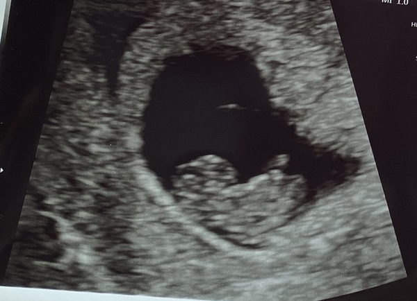 Early scan