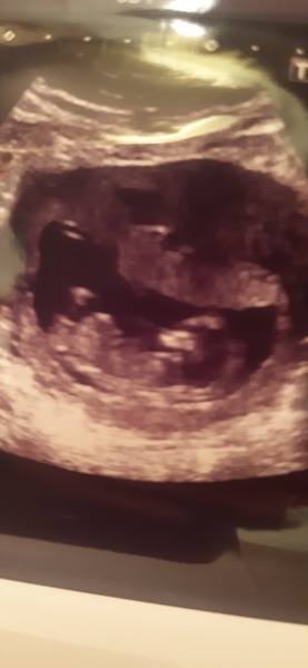 Boy or girl?