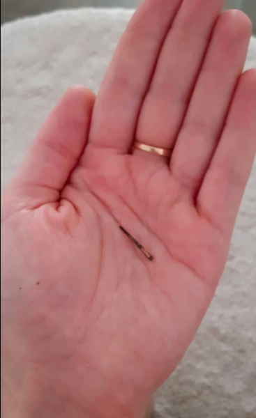Sudden onset limping, but only after rest?