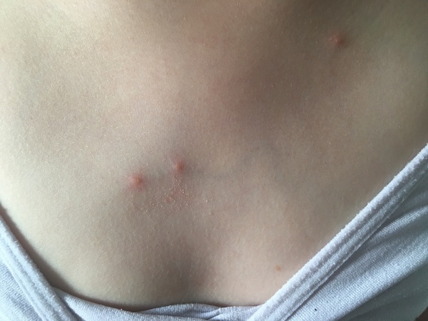 What are these spots? (Photo)