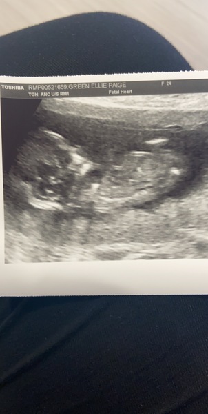 12+4 scan..guess the sex for fun!