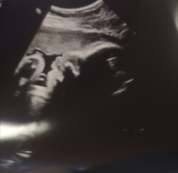 Pregnant after Loss and Dreaming of Rainbows - 5