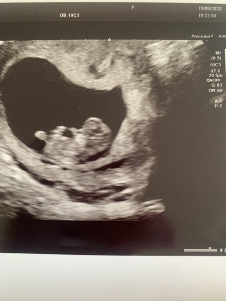 Old ovaries, new lines