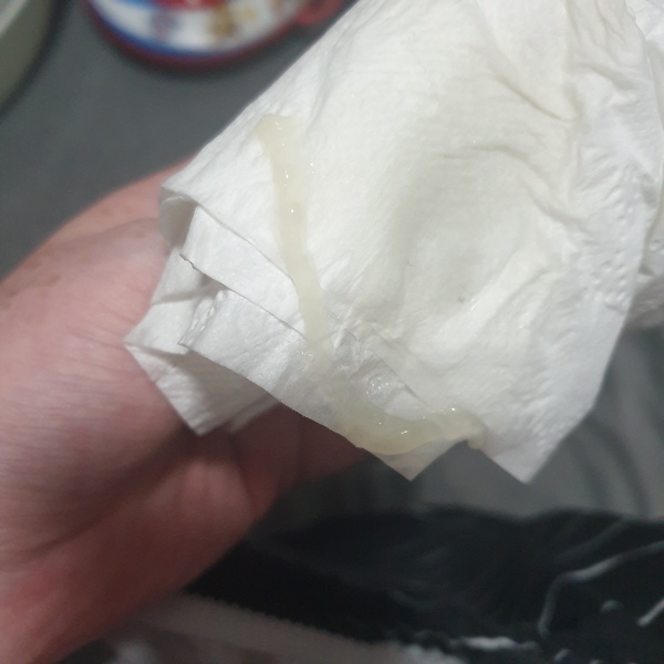 Discharge or part of plug?