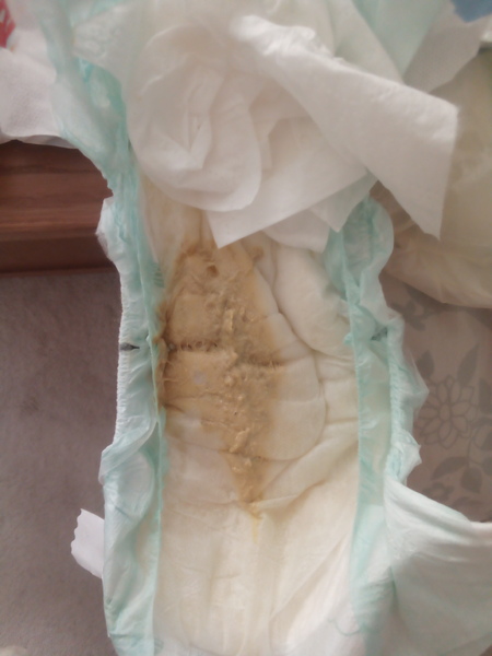 Would you consider this poo light coloured? **Sorry, pic**