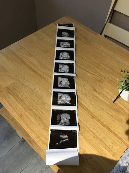 Pregnant after Loss and Dreaming of Rainbows - 5