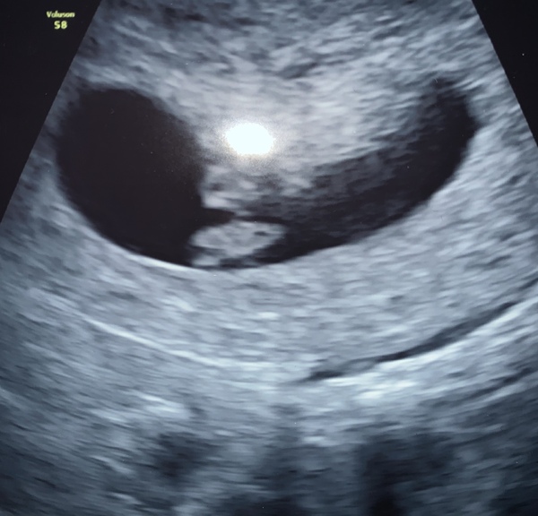 March 2021 babies