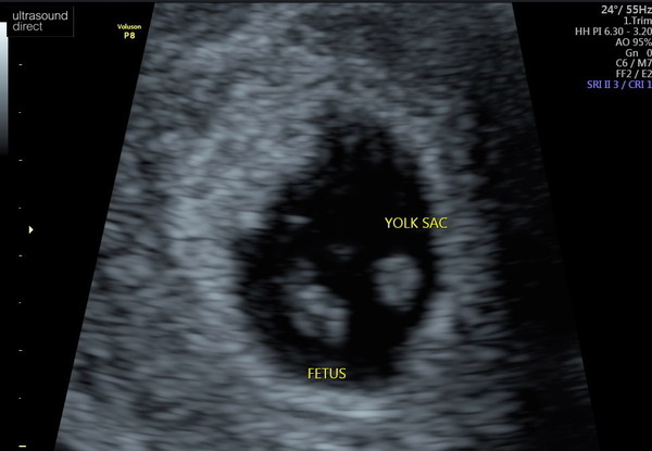 Old ovaries, new lines