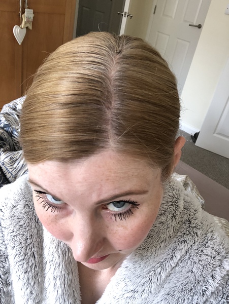Seriously struggling with hairloss...