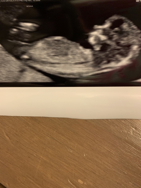 12 week scan - boy or girl?