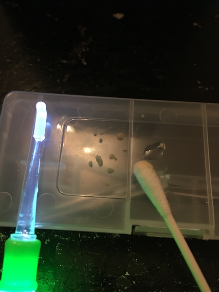 Any Tonsil Stone Sporners?