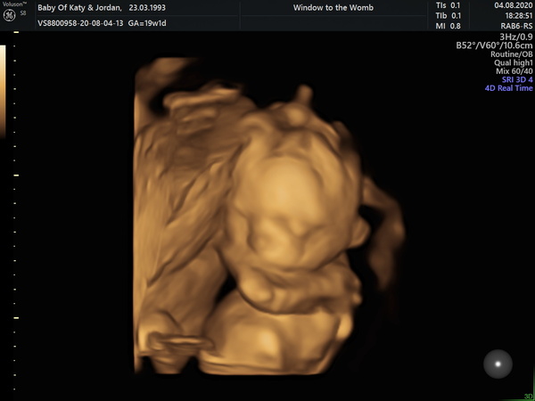 Christmas babies thread 4!