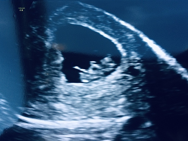 March 2021 babies