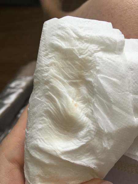 Pregnant After MMC - Thread 2