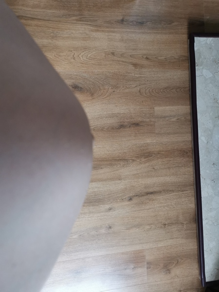 Is this diastasis recti?