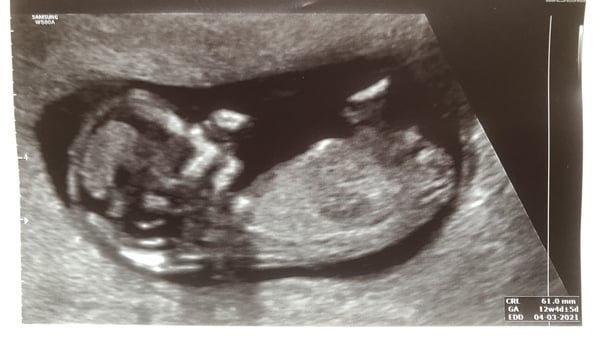 March 2021 due dates