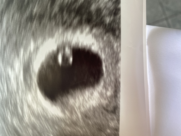 March 2021 babies