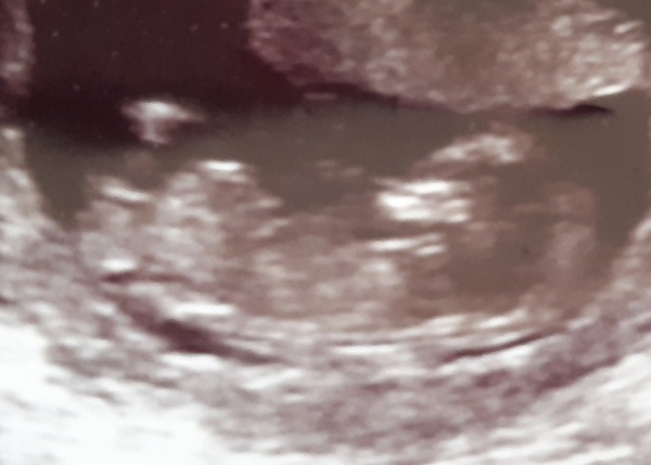 Boy or girl?