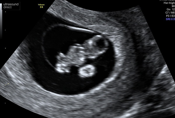 Early scan