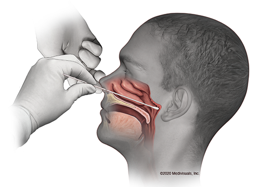 Aibu to refuse this Covid test?