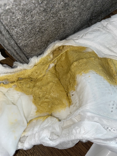 Help with looser baby poo (photo)