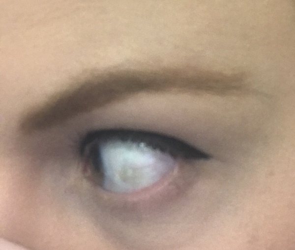 Bit of a long shot but any opticians about?