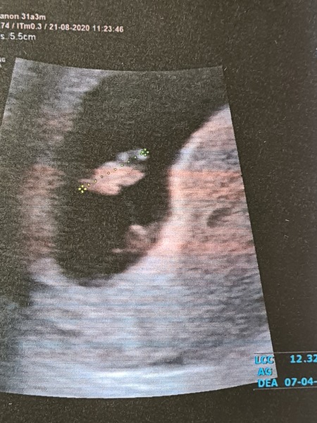 Early scan