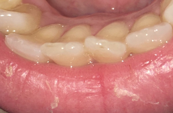 Any dentists around? Worried oral cancer.