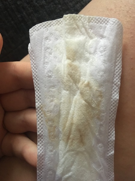 Pregnant After MMC - Thread 2