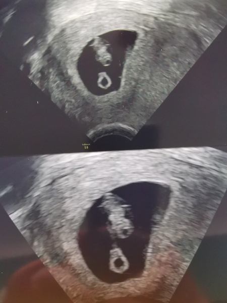 March 2021 due dates
