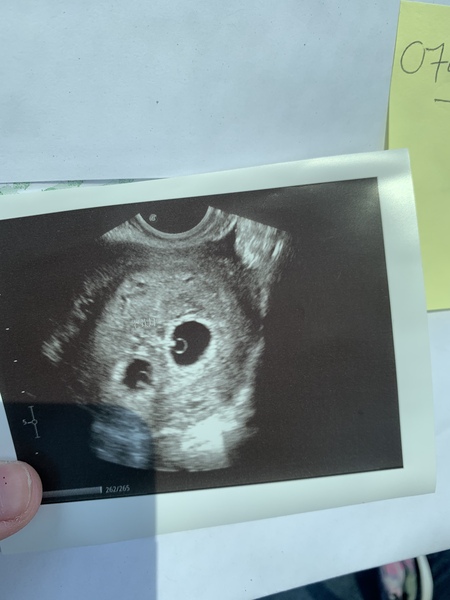 Twins HELP!