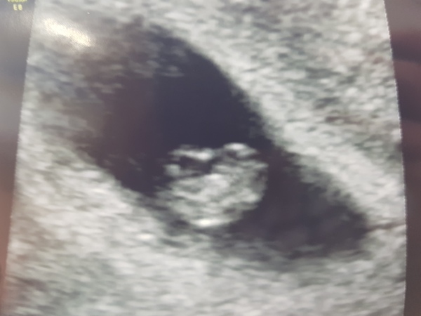 March 2021 babies