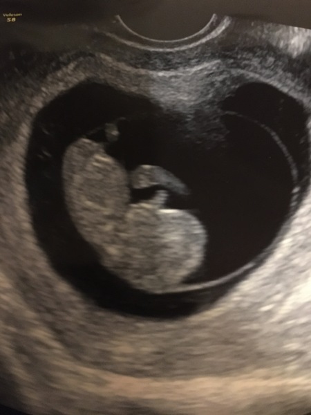March 2021 #2