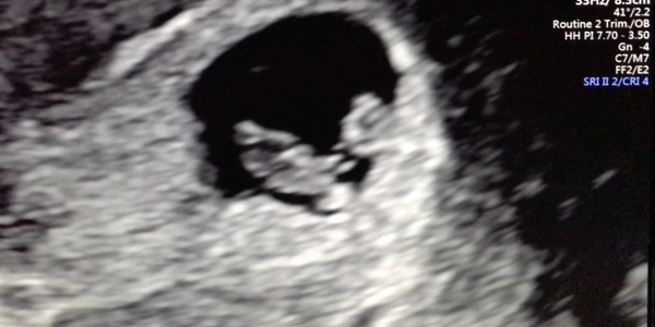 Due April 2021