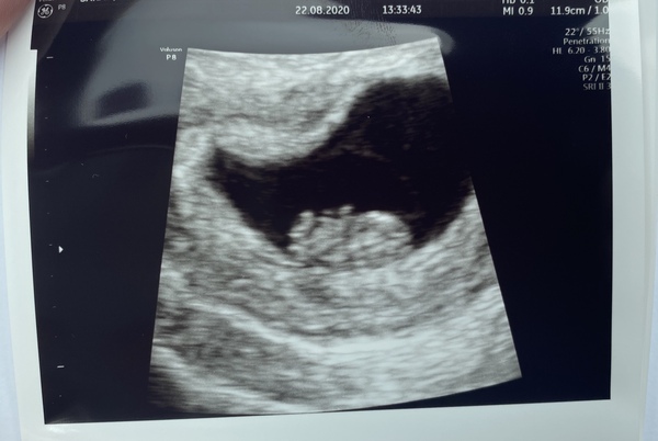 Early scan