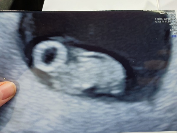 March 2021 babies