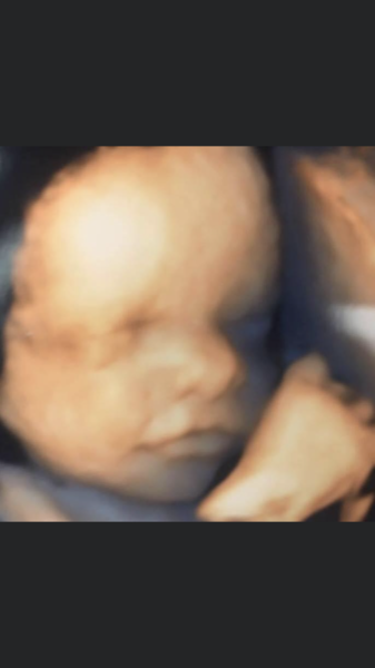 Best time to have private scan (not for gender!)