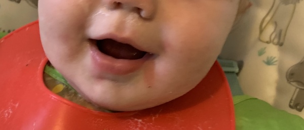 Does this look like an allergic reaction