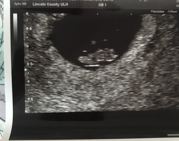 🦕 Catching up - ttc after miscarriage part 4 🦕