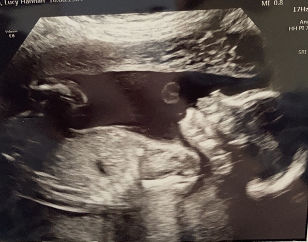 Christmas babies thread 4!
