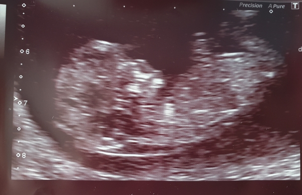 Boy or girl? Just for fun :)
