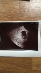 Pregnant After MMC - Thread 2