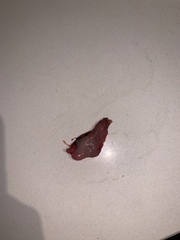 Warning- graphic tmi photo. Found this on period pad this morning