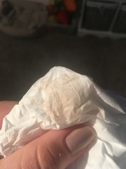 Pregnant After MMC - Thread 2