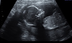January 2021 due date bus 4