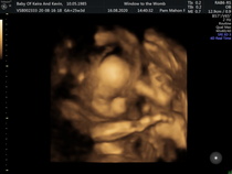 👣 Due Nov/Dec 👣 the second trimester continues