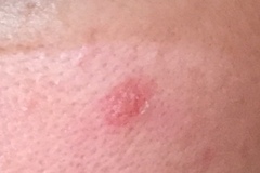 Should I get this checked out?